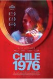 Chile, 1976 / Chile '76 (2022)
